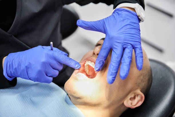 Best Emergency Broken Tooth Repair in Mattituck, NY